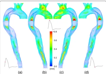 Figure 2 Displacement of the vessel wall at various time instances. Contours show the displacementrelative to the undeformed geometry at (a) mid systole, (b, c) peak systole (d) dicrotic notch.