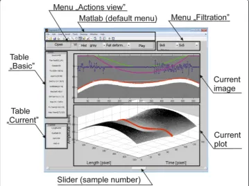Figure 1 Main window in the program. The division of the main window into several sectors is clearly visible.The sectors form the menu items - on the left and on top, as well as items related to visualization - on the rightat the bottom and in the middle of the window.
