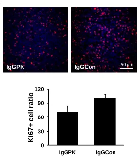 Figure 2-1E Ki-67 staining of SW620. 