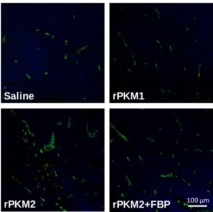 Figure 2-2F CD31 staining of SW620 tumor treated with recombinant proteins. 