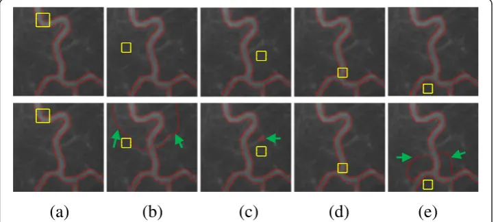 Figure 5 Segmenting a hand phantom using the GCV and the proposed model.green rectangle in (b), Illustration of theperformance of segmenting a hand phantom (downloaded from [13]) using the GCV and the proposedmodel: (a) initial contour, (b) segmentation re
