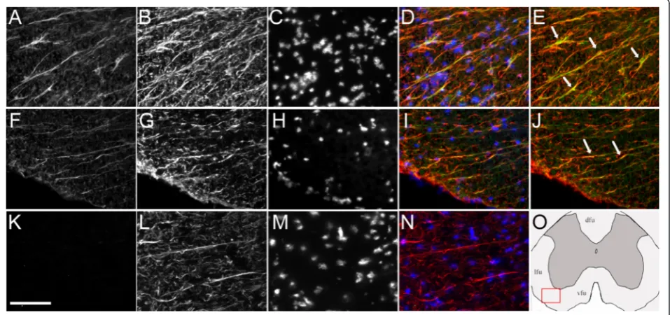 Fig. 3 Astrocytic SULT1A immunoreactivity in the EAE and control white matter spinal cord