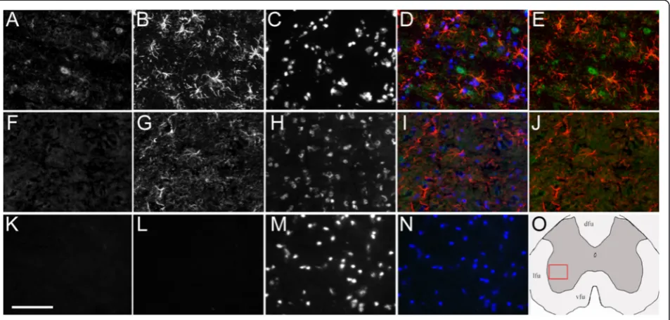 Fig. 4 Lack of SULT1A1 immunoreactivity in astrocytes of the gray matter spinal cord. Representative stainings for EAE mouse (aea–e) or controlmouse (f–j), and for non-specific control (k–n)