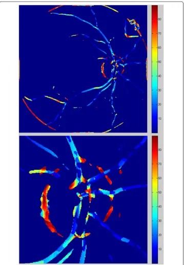 Figure 10 Image Lcalculated in accordance with Cartesian coordinates, which centre is located in the centre of the optic disc.Additionally, the angular values are modified and indicate the angle measured against the radius
