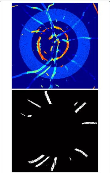 Figure 11 Enlarged image Lautomatically selected fragment of analysis comprising the range from 2r to 3r of optic disc radius.Only objects (vessels) visible in the analysed area (2r to 3r) will be further analysed.analysis will be related to the determinat