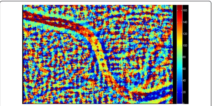 Figure 5 Fragment of image Lvisible bright area will also be the basis for vessels segmentation