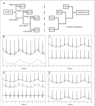 Figure 3 Removing baseline wandering in ECG. (a) Discrete wavelet transform of ecg(n) to find coefficientsequences hk(n), gk(n), gk−1(n), · · · , g1(n)