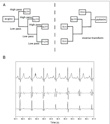 Figure 4 Selection of wavelet scale to find the time positions of QRS complexes. (a) Discrete wavelettransform and inverse transform
