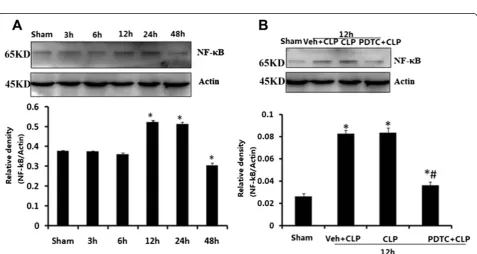 Fig. 4 Beclin1 (a), LAMP-1 (b), and Rab7 (c) in brains harvested 3, 6, 12, 24, and 48 h after CLP