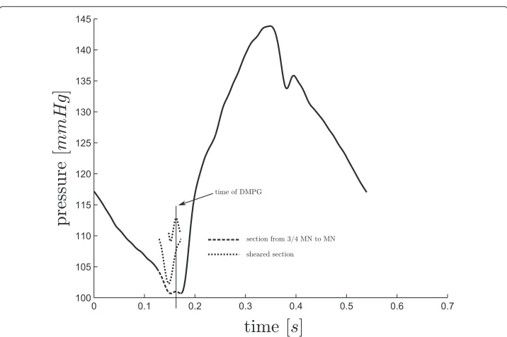 Figure 9 Finding DMPG, A. A straight forward case for finding DMPG, where P1 of (17) exists, henceDMPG ≡ P1.