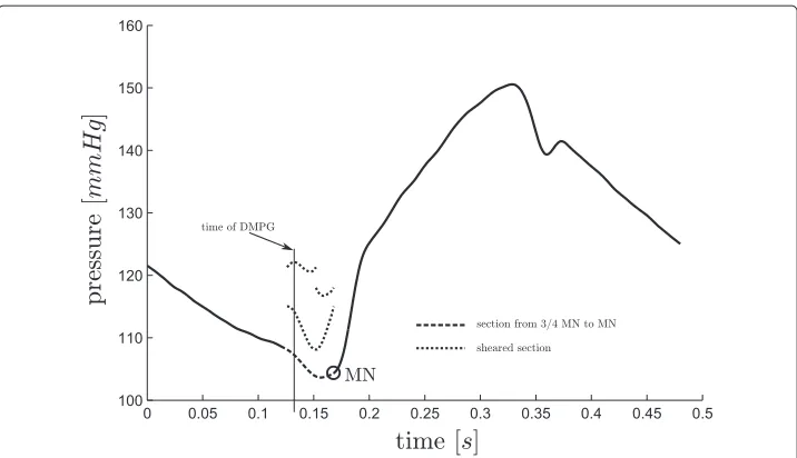 Figure 11 Finding DMPG, C. A less common case for finding DMPG, where P1, and P3 of (17) do not exist,but P4 does, hence DMPG ≡ P4.