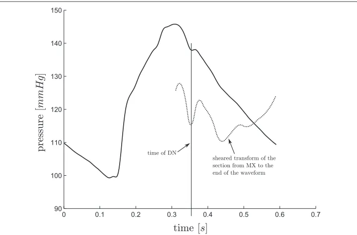 Figure 12 Finding DN. An example of where the first local minimum of the shear transform is the correcttime for the point DN.