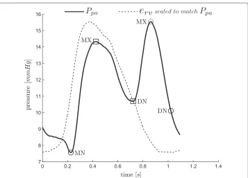 Figure 13 Where the method fails. Ppa alongside the matching TVE. The automatic or algorithmic methodfailed to capture the correct DN point (circle), the real DN and associated MX are marked by squares.