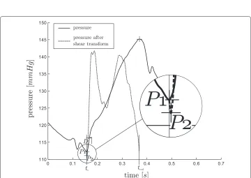 Figure 6 Use of the shear transform, A. The desired point forbetweentime of MN is P. However, in this example the globalminimum of the waveform is P1, which is the initial guess for MN