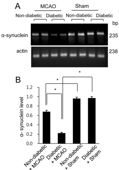 Figure 4. Reverse transcription PCR analysis of expression in the cerebral cortices of non-diabetic + sham,diabetic + sham, non-diabetic + MCAO, and diabetic + MCAOanimals