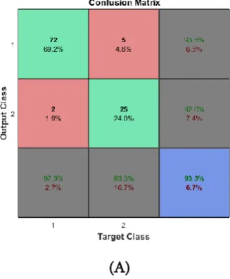 Figure 4 : Receiver Operating Characteristics of A. 