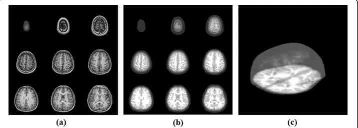 Figure 6 The tomograms with different depths of the brain. This figure shows the result of opticalbrain modeling from in vivo MRI data