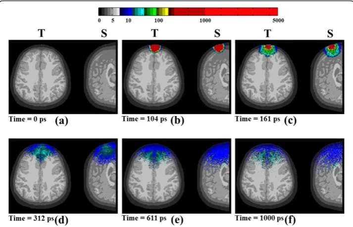 Figure 8 The spatial sensitivity profile with various source-detector separationsthe photon migration of the received photons with different distances of source-detector separation