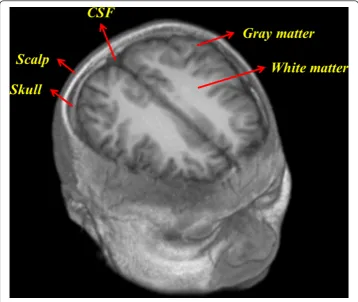 Figure 2 Segmentation of scalp and skull layer. This figure shows the segmentation process of scalpand skull: (a) two-dimensional anatomical MRI images, (b) contours segmentation with level set operator,(c) boundaries of the scalp and (d) skull layer, and (e), (f) segmentation with region growing approach(scalp = 1, skull = 2), (g) the two layers modeling of the scalp and skull.