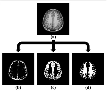 Figure 4 The three-dimensional brain model with five layers. Five layers three-dimensional brainstructure in Monte Carlo simulation: (a) one slice of brain model with five layers, (b) reconstructed threedimensional brain model, (c) original three dimensional MRI data.