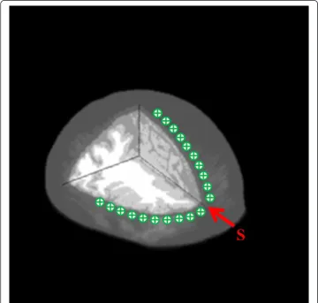 Figure 5 The geometric configuration of source-detector. The source-detector separations on humanhead model in simulation with transverse view and sagittal view