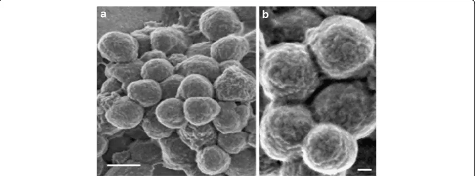 Figure 1 Field emission scanning electron microscopy of K14 inclusion bodies. (a) Most obtained K14 IBs were spherical in shape