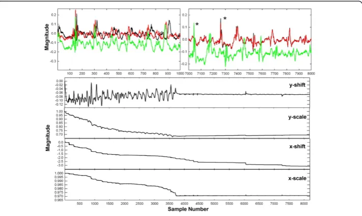 Table 1 Trials for New LMS Algorithm – Paroxysmal AF