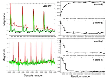 Figure 7 Application of the LMS algorithm to lead aVF of the electrocardiogram in a persistentAF patient