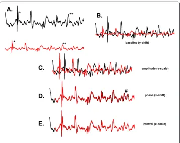 Figure 2 Differences in extrinsic features of signal space, shown as graphs.