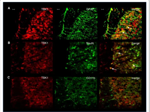 Fig. 1 TBK1 expression in the dorsal spinal cord. Representative co-immunofluorescence showing TBK1 protein expression in the dorsal horn ofspinal cord in combination with cell markers for (a) astrocytes (GFAP), (b) neurons (NeuN), and (c) microglia (CD11b