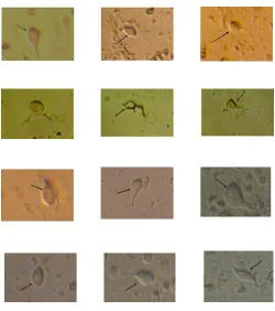 Figure 7. The dissociated LC neurons The LC tissue was dissociated using Papain from WT mice