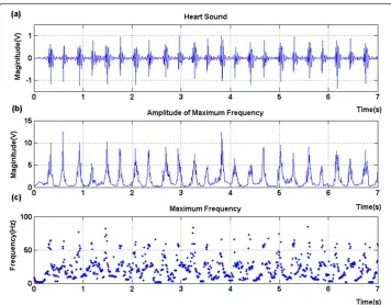 Figure 3 A normal heart sound record (a). The magnitude (b) of the maximal instantaneous frequency(c) was indicated as well.