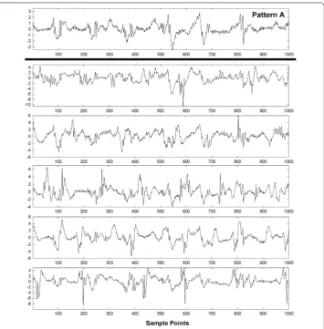 Figure 6 Example of pattern A before interference is added (top graph) and after ﬁve differentinterferences are added (lower panels).