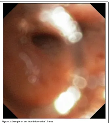 Figure 2 Example of an “non-informative” frame.