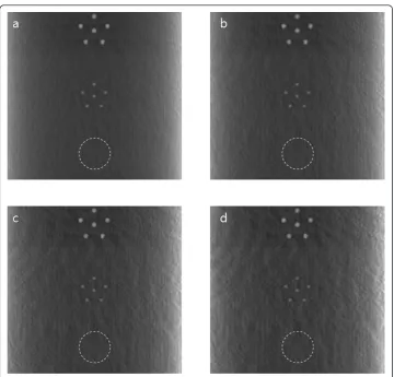 Figure 6 The misalignment effects in simulated local tomosynthesis images. The images have beenobtained with misregistration between the CT and tomosynthesis scan geometry