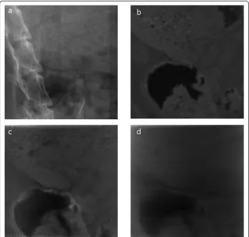 Table 2 CNRs measured at the three feature patterns in the experimental images