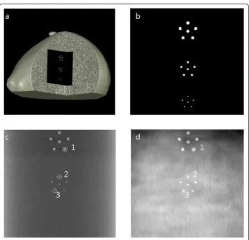 Figure 4 The breast-mimicking phantom for simulation and its simulated tomosynthesis images