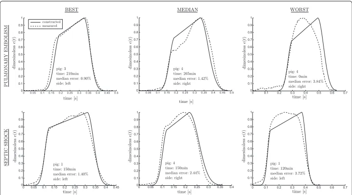 Table 5 Cross validation reconstruction errors for pulmonary embolism and septic shock