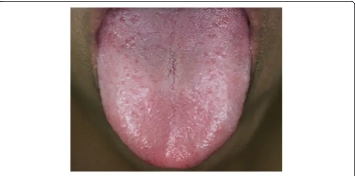 Figure 1 The captured tongue image.