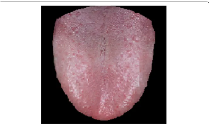 Figure 2 The pure tongue image through edge segmentation.