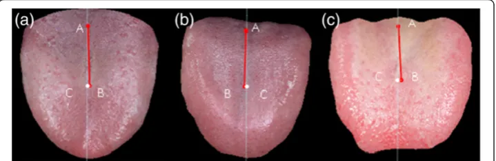 Figure 6 The tongue images of 3 normal subjects respectively with deviation angles = 0.74, 1.2, and2.5 degrees.