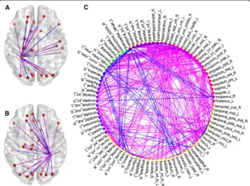 Figure 4 The functional connections of the fusiform gyrus and the whole brain.connectivity between the left fusiform gyrus and other brain regions