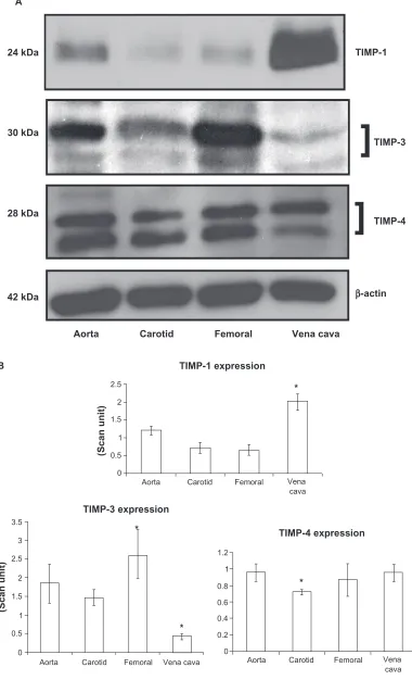Figure 5 Differential expression of TIMPs in vascular beds. A) Western blot analysis. B) Bar graphs of scanned intensity values