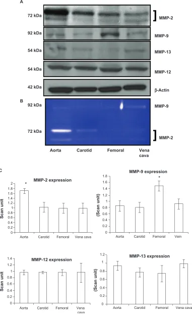 Figure 4 Differential expression A) activity B) and C) bar graphs of scanned intensity values of MMPs in different vascular beds
