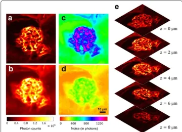 Figure 6 Histograms of QSIM-calculated sectioned image and wide-field image. (a) Histogram of lightenergy