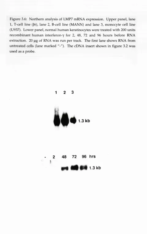 Figure 3.6: Northern analysis of LMP7 mRNA expression. Upper panel, lane 