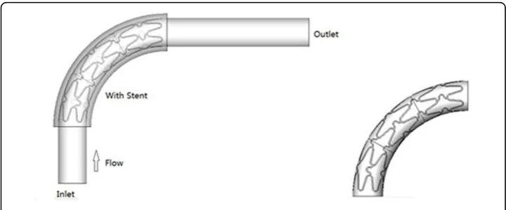 Figure 1 Curved stent model.