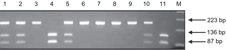 Table 1 The sequence of primers