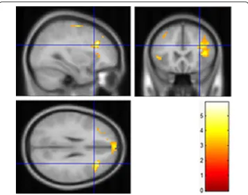 Table 6 The more strongly activated sites produced by watching front depth of fieldimages compared to that of the back one