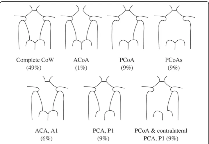 Figure 1 Some common variations of the Circle of Willis [48].